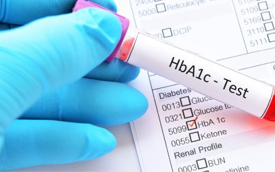Diabetes HbA1c Screening