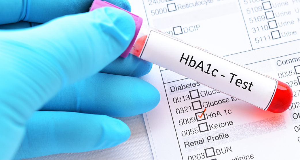 Diabetes HbA1c Screening